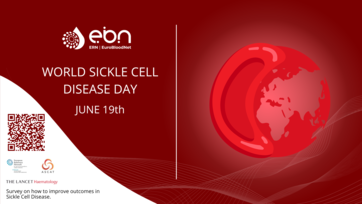 For World Sickle Cell Day 2024, ERN-EuroBloodNet is gathering the voices of people living with Sickle Cell Disease globally via a survey.